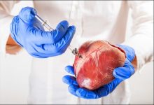 now-ai-can-predict-heart-disease-before-it-strikes