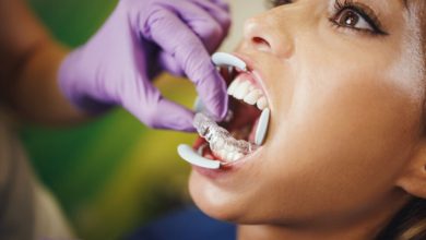 top-5-reasons-to-get-invisalign-in-palos-verdes-instead-of-braces