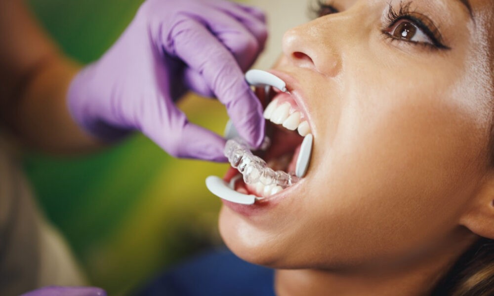 top-5-reasons-to-get-invisalign-in-palos-verdes-instead-of-braces
